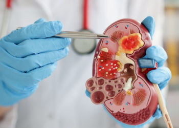 6 Minuman Alami Ini Bisa Membersihkan Ginjal, Ada Jus Lemon Hingga Air Putih