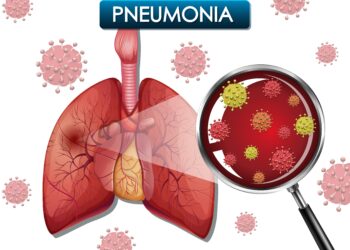 WHO Sebut Pneumonia Salah Satu Penyebab Kematian Tertinggi Pada Anak. Berikut Penjelasan Dokter Cara Penanganan Pneumonia Sesuai dengan Penyebabnya