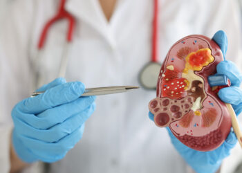 Jangan Abaikan 8 Gejala Batu Ginjal, Termasuk Nyeri di Bagian Tubuh Ini