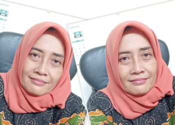 Dinkes Lumajang Klarifikasi Tayangan Viral di TikTok @pedomanindonesia.co.id Terkait Program Kesehatan Gratis