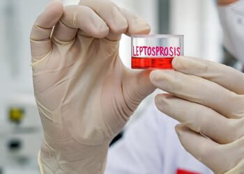 Antisipasi Dini di Tengah Peralihan Musim, Pemkab Lumajang Edukasi Warga soal Leptospirosis